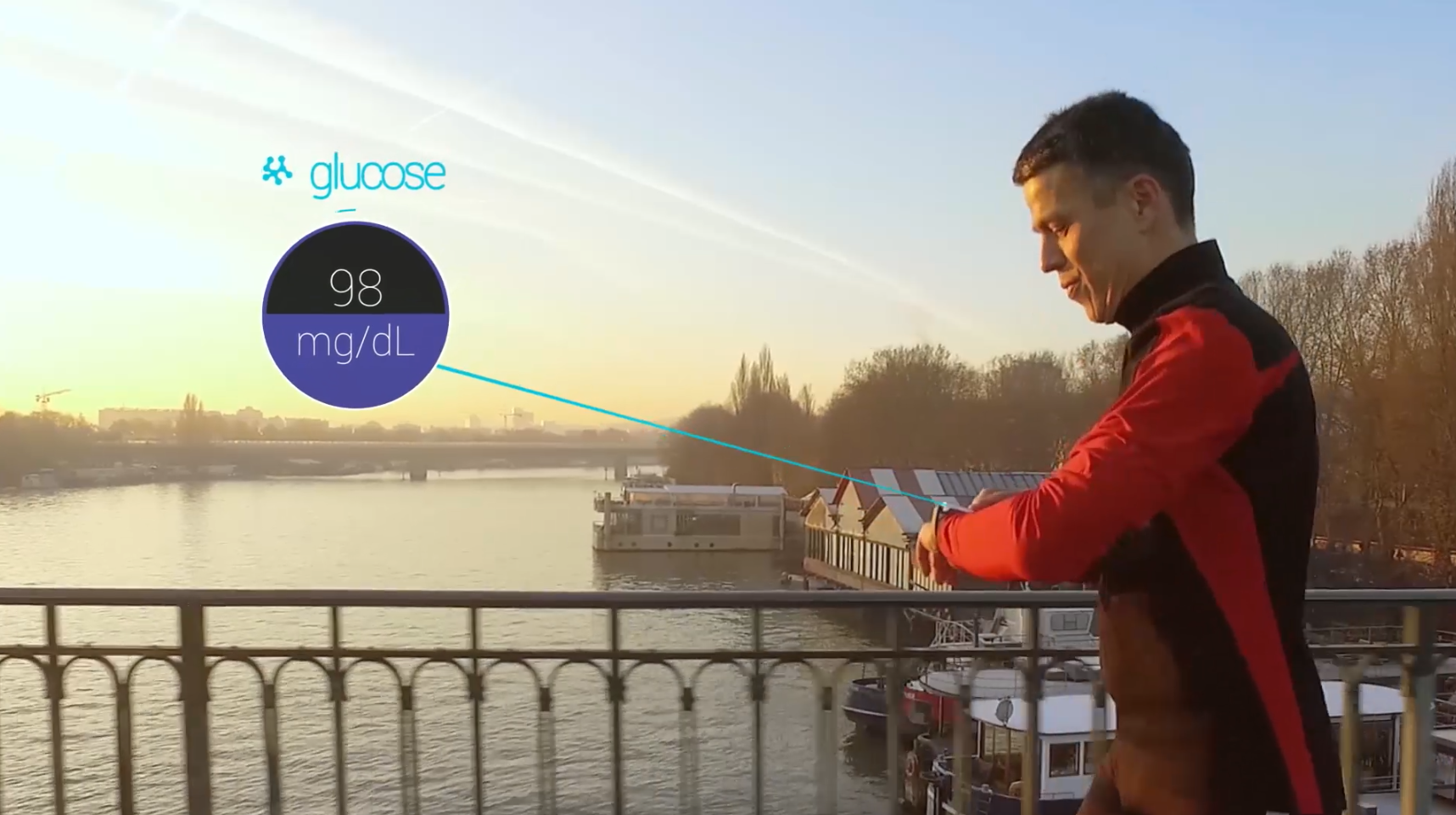 K'Watch Glucose : une solution facile et sans prélèvement sanguin pour suivre son diabète. © PKvitality